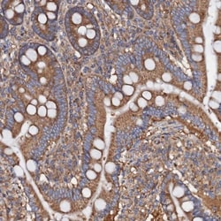 MRPL48 Antibody, Novus Biologicals:Antibodies:Primary Antibodies